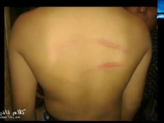 Cairo pupil receives 40 lashes from teacher
