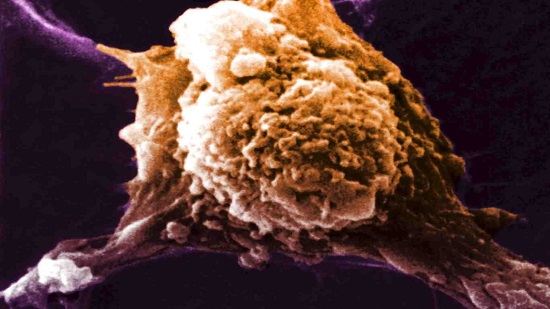 'Universal cancer vaccine’ breakthrough claimed by scientists