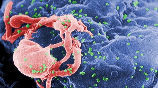 Girl’s HIV infection seems under control without AIDS drugs