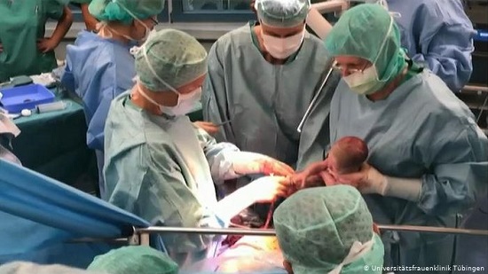 Two children born in Germany for the first time after uterus transplant
