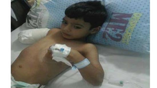 Doctor in Minya referred to investigation after causing the amputation of a childs arm